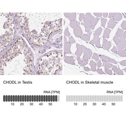 Chondrolectin Antibody, Novus Biologicals 0.1mL; Unlabeled:Antibodies,